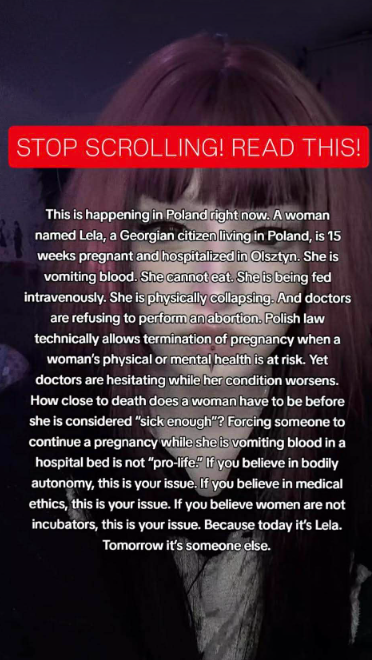 Igor 🖤 tweet media