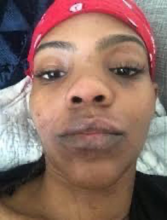 They are getting angry over pictures funny how they can do it to Erika nonstop but once you play the game back rage sets in.