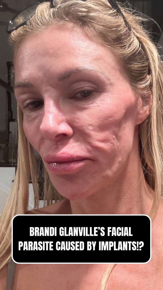 Nicole Angemi, MS, PA (ASCP) tweet media