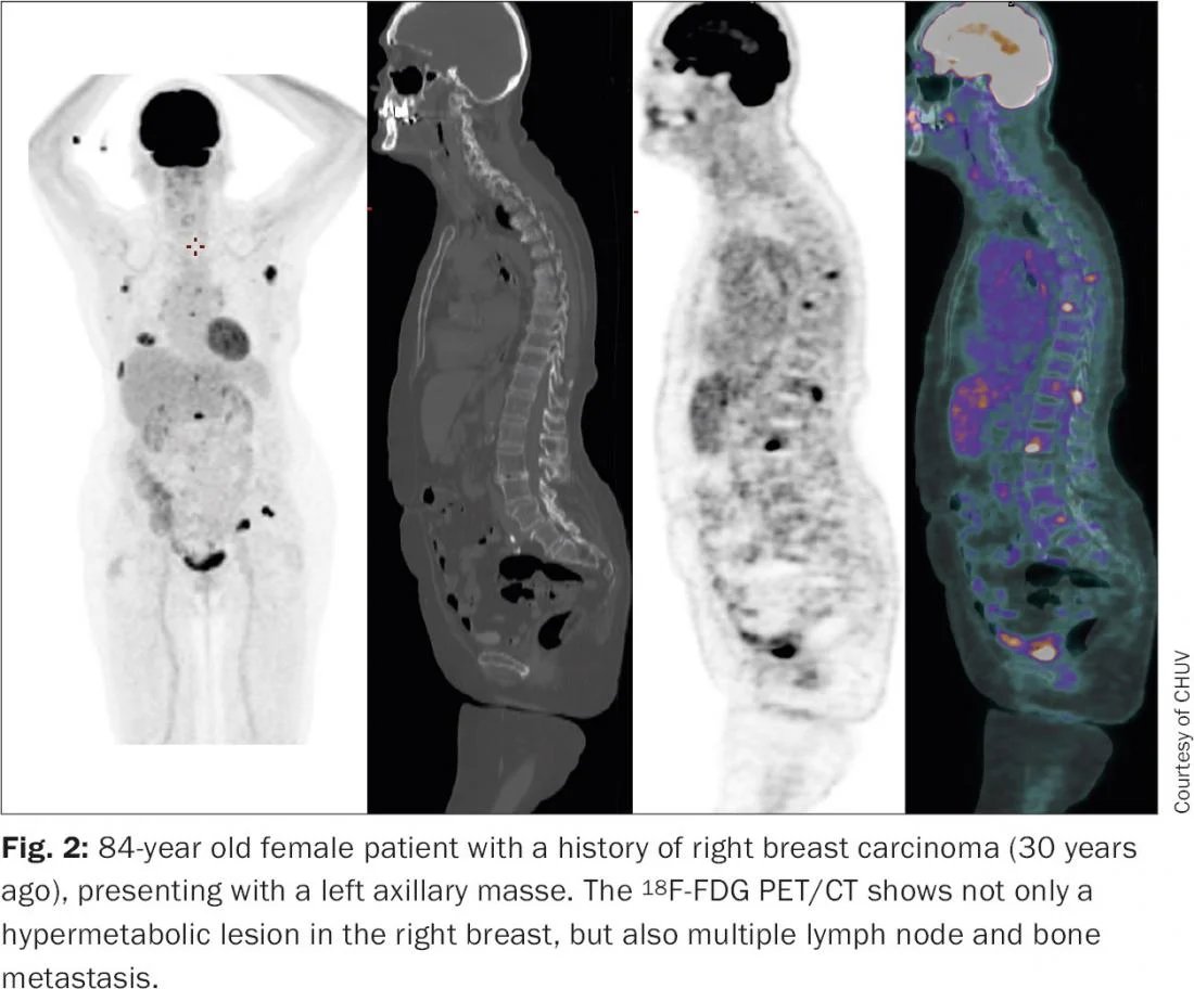 Barcamenandro tweet media