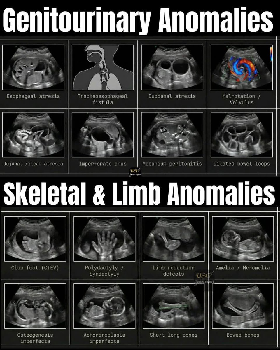 EchoTech tweet media