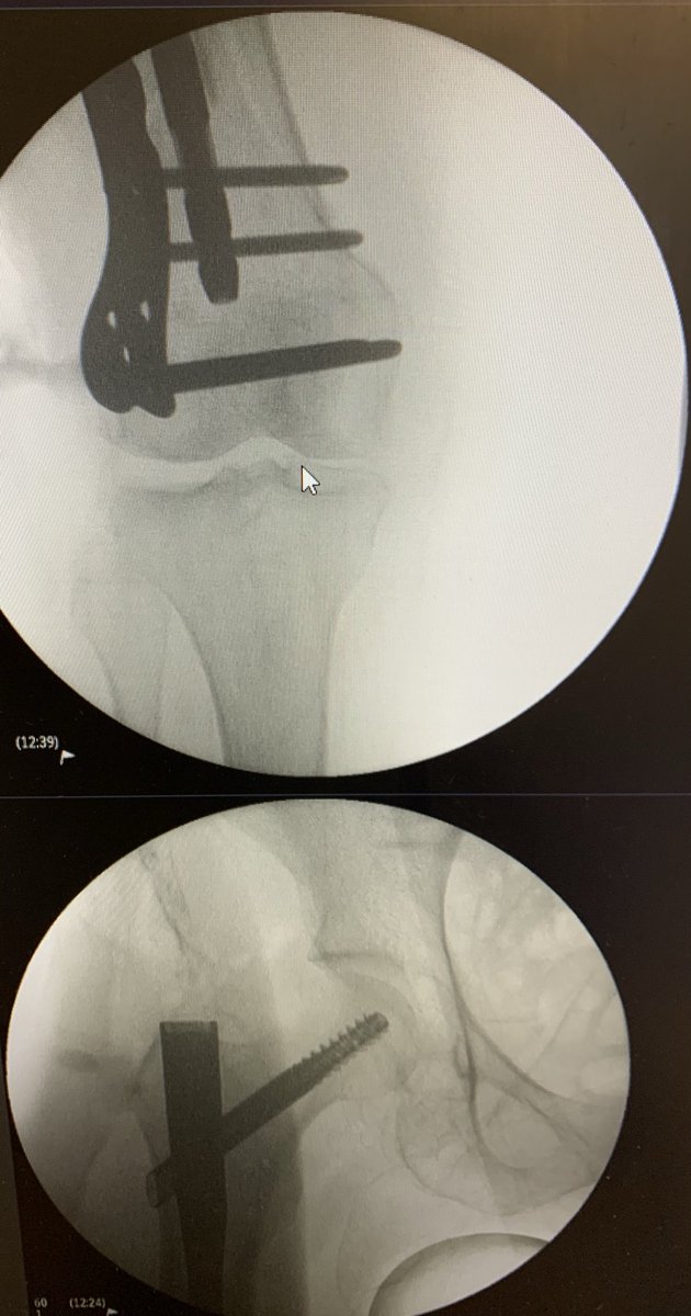 SP Orthopaedics tweet media