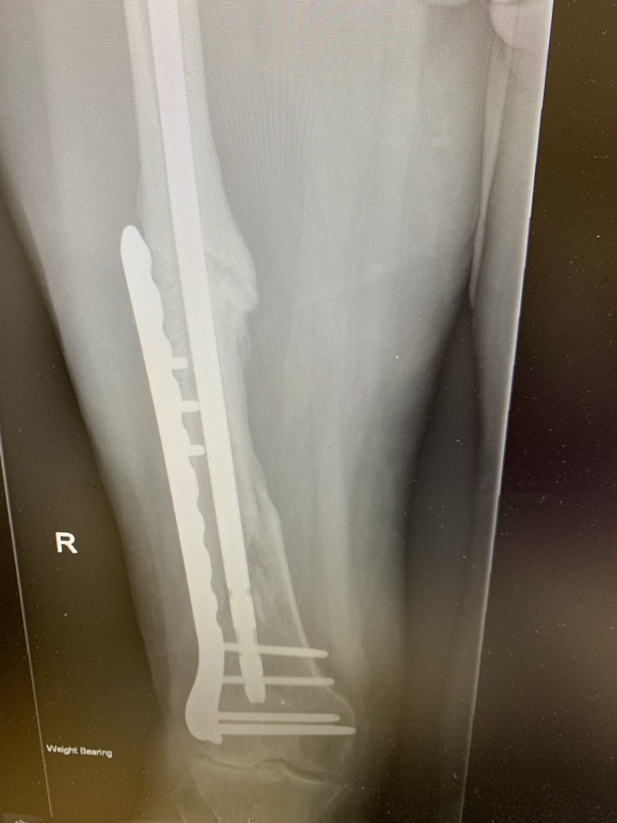 SP Orthopaedics tweet media