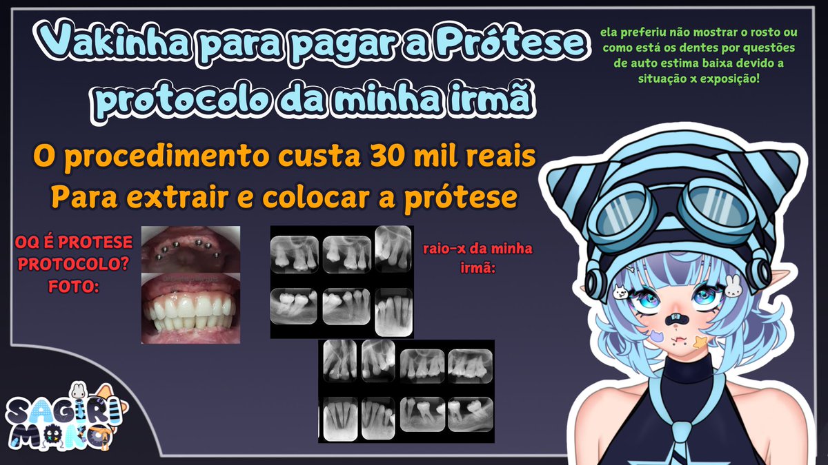 Boa noite povo!

Resumidamente, minha irmã de 31 anos teve uma perda óssea nos dentes, e terá que extrair todos os dentes e colocar uma prótese protocolo

o custo é mt alto para nós da familia no momento
então fiz uma vakinha p ajudar no custo
qualquer ajuda é bem vinda!  obg!🩵