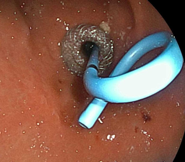 Muhammad Arslan Baig tweet media