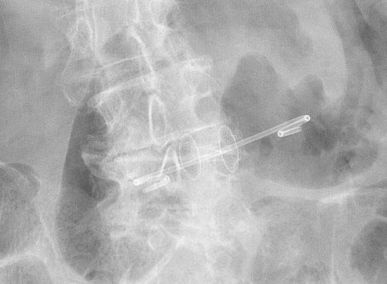 Muhammad Arslan Baig tweet media