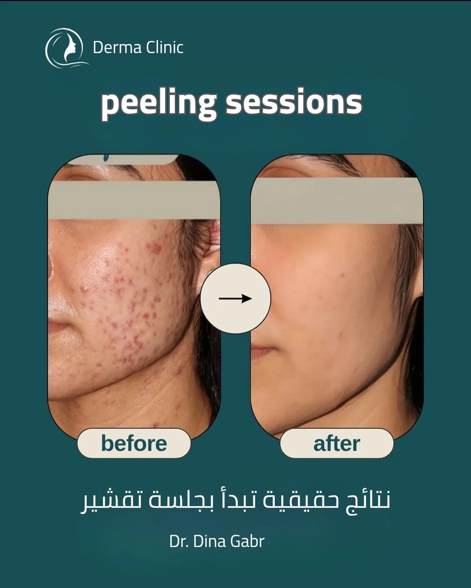 DERMA Clinic (@DERMAClini1096) / Posts / X