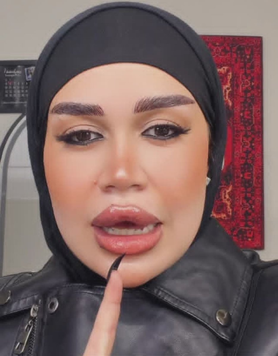 افكر فين الدعم