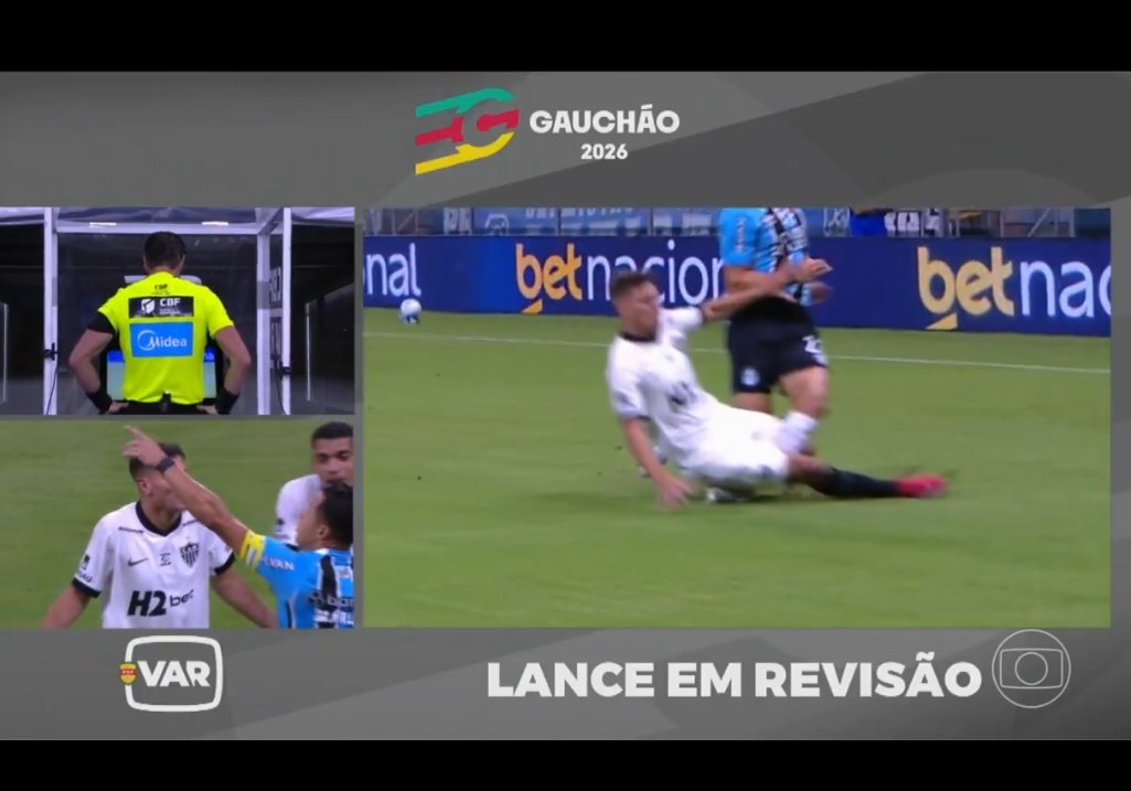 O atleticano que abre a boca pra falar que isso aqui não é pra VERMELHO 🛑,pode parar com futebol.
É muito pra vermelho,poderia ter quebrado a perna do jogador do Grêmio.
Natanael QI de uma anta