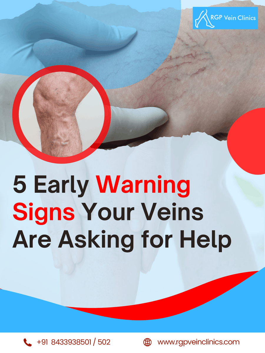 ProfRGPatil's tweet photo. Heavy, tired legs? 
Spider or bulging veins? 
Night cramps? 
Ankle swelling? 
Itching over veins?

These are early warning signs of varicose veins. 
Don’t ignore them. Early diagnosis means simpler treatment.
📞 +91 8433938501
🌐 https://t.co/FNatGeOtLl
#varicoseveins #veincare https://t.co/kErWCcCVPh