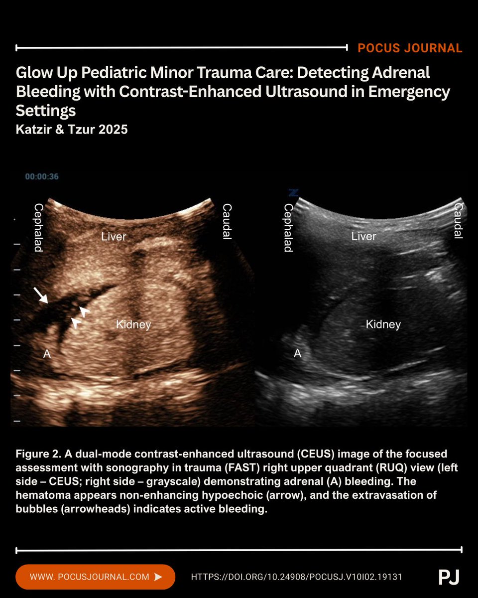 POCUS Journal tweet media