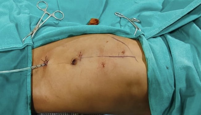 Dr Chandra Mohan Vaddi tweet media