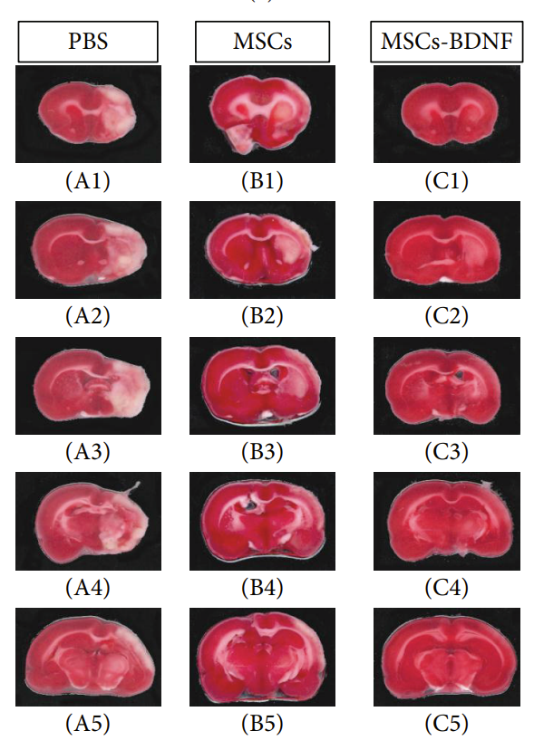 exosome's tweet image. Mesenchymal stem cells healing a broken #brain.

See how potently they reduce infarct size after #stroke?

See that ??? and people used to say that "adult stem cells" dont work....they work.. !

pmc.ncbi.nlm.nih.gov/articles/PMC39…