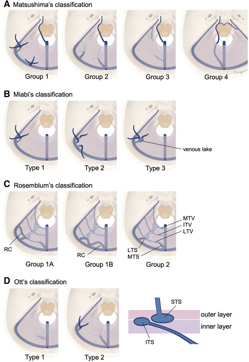 JNET(Journal of Neuroendovascular Therapy) tweet media