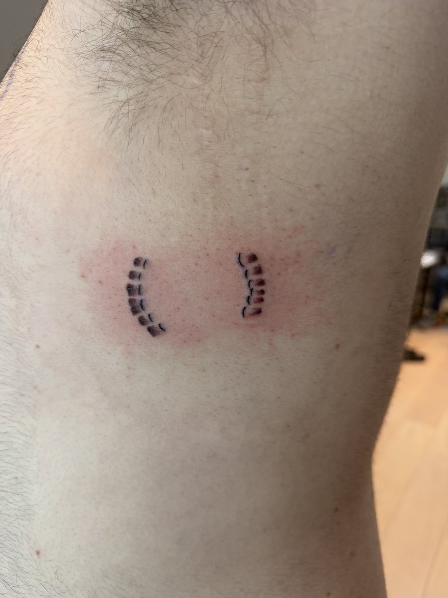 VanasPup's tweet photo. Puppy spent a long weekend in San Fransisco! Play parties, tattoos, beer busts, and a lot of Sir’s feet.

Puppy was surprised with Sir’s bite mark on its ribs! Thank you Sir! @GeoffMillard https://t.co/xV7EwUiiDE