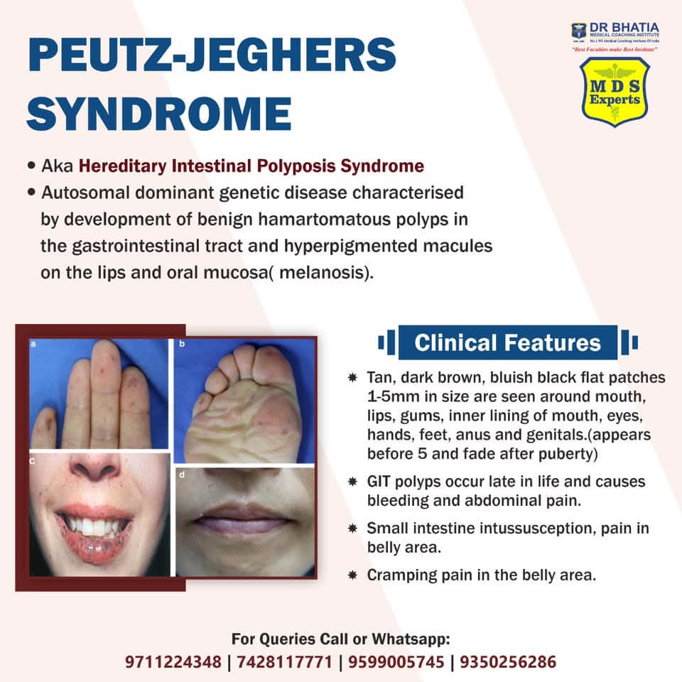 <a href="/schowardjd/">Scott C. Howard</a> Oral mucosal involvement other areas<anus?,genitalia??>+sinusitis + medical student saw it first was it on osce😄

Gerd+family hx

Petz-Jeghers Syndrome <,hereditary intestinal polyposis Syndrome >
Triad
<LAps+GIt polyps+patches around the mouth>
Screen for ca !
<Cc:FB>