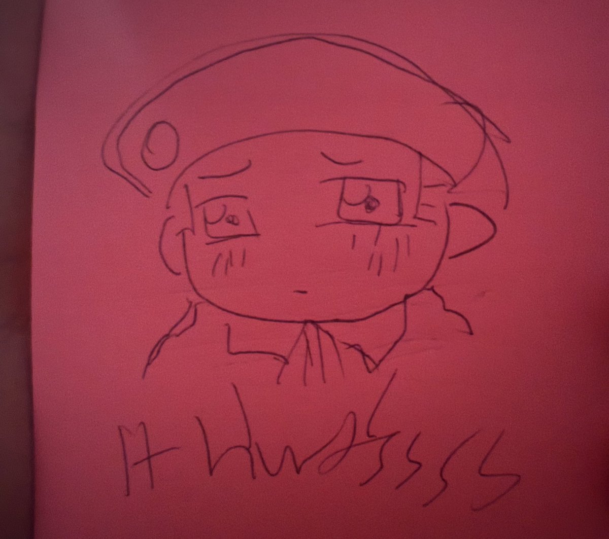 I got teeth removed last week and drew hre under anesthesia