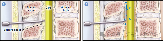 Anesthesiology and Perioperative Science tweet media