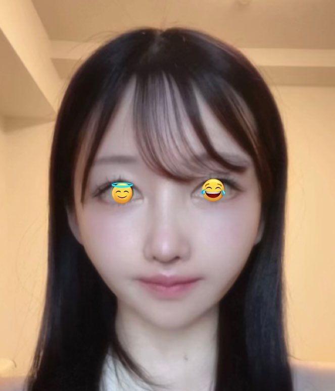 17dsy_'s tweet photo. 両顎手術無しでこれなので、希望にしてほしい https://t.co/FU2Pnz7Lw9