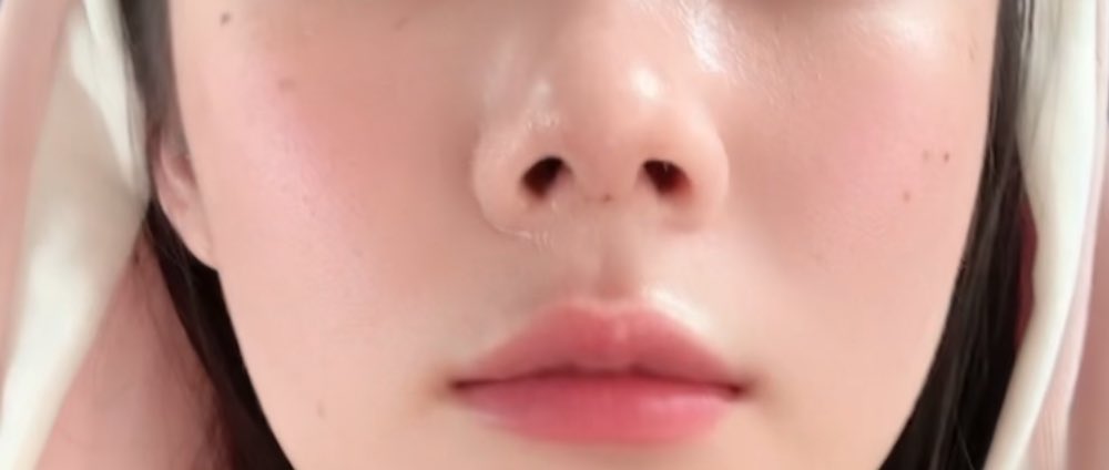 ７@鼻整形DT tweet media