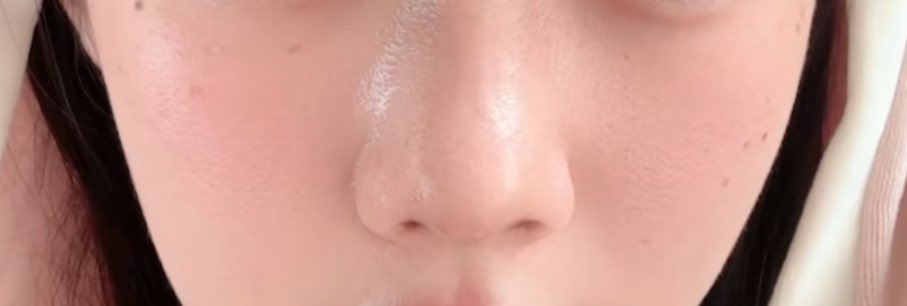 ７@鼻整形DT tweet media