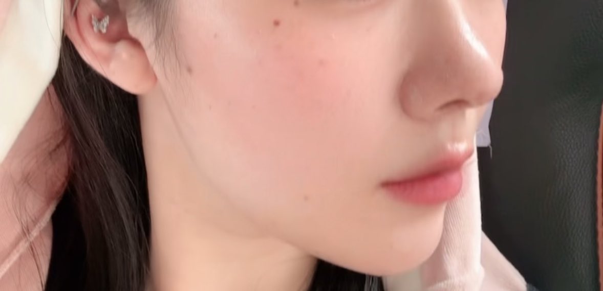 ７@鼻整形DT tweet media