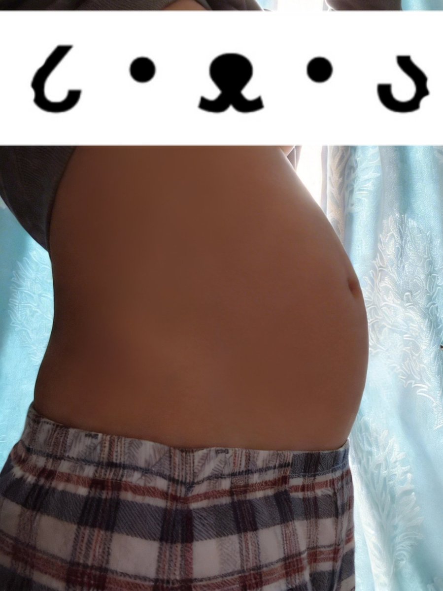 Aurora•᷄ v •᷅ tweet media