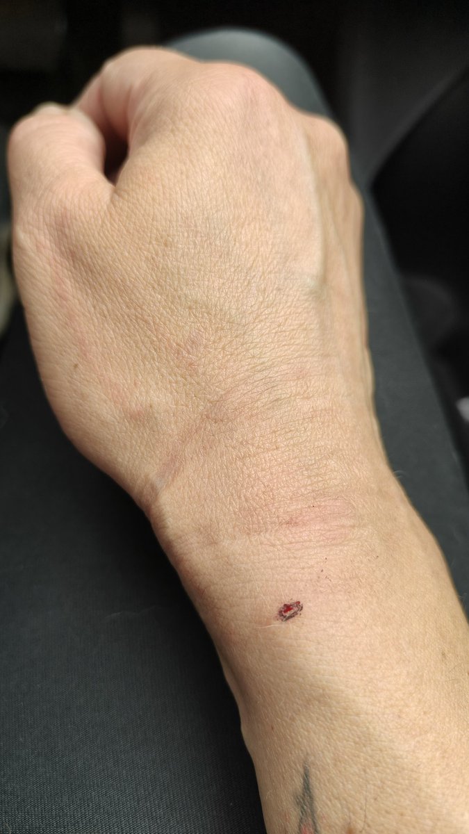 Ironmanks tweet media