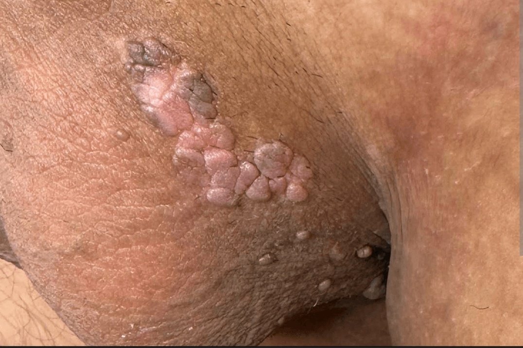 🇵🇭Al tweet media