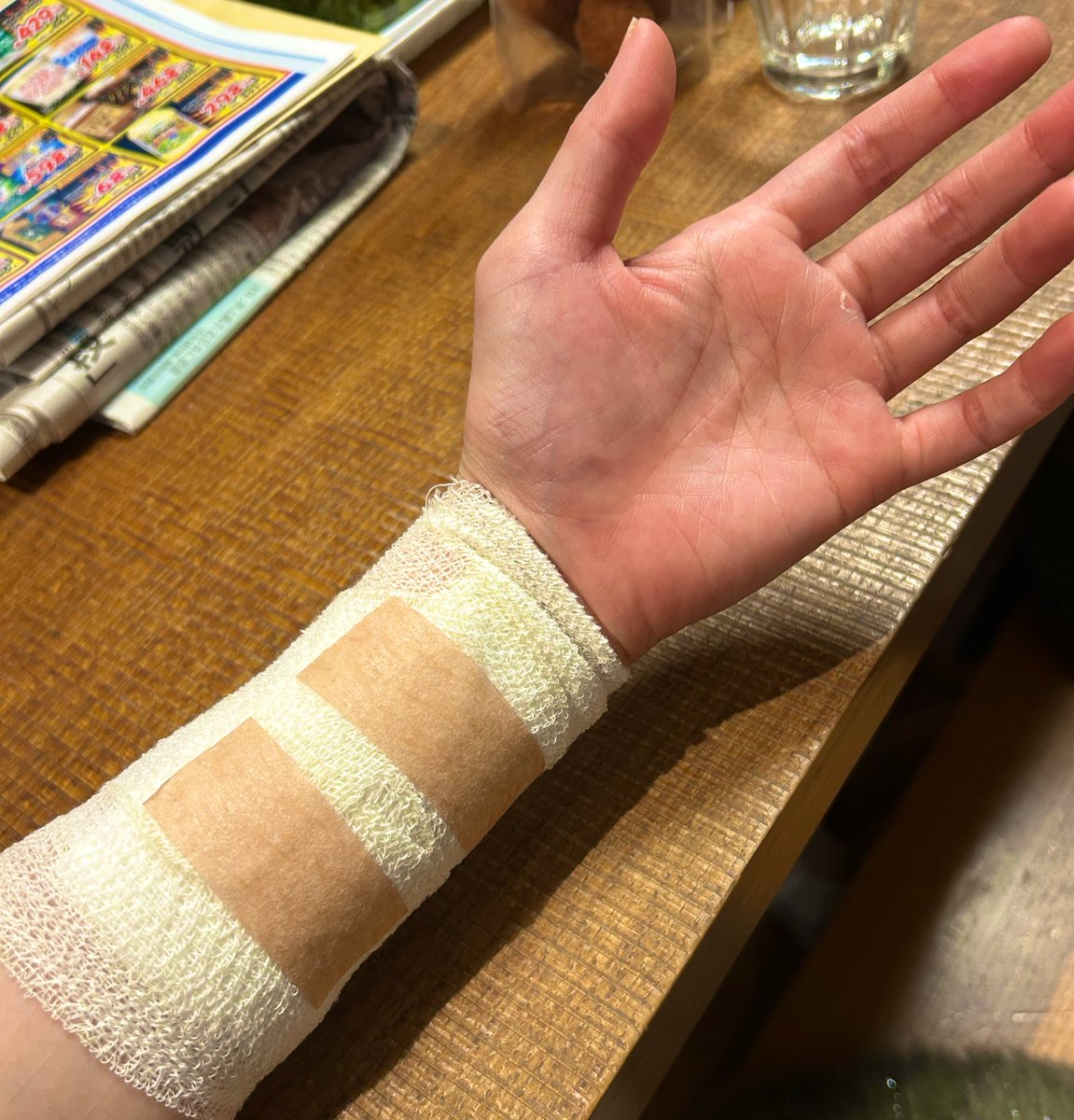Hazking6's tweet photo. 火傷した！😭溶接中に革手袋と袖の間の皮膚が露出しているのを気にせず、固定していたかったからそのまま至近距離の部分でスパーク浴びてた心当たりある🫠のちに広範囲蕁麻疹レベルの赤い跡&amp;全面チクチク痛痒い感覚。妹に処置してもらったけも低温火傷だろうし、明日様子みて皮膚科行こ…😭 https://t.co/I0XDxOQwoZ