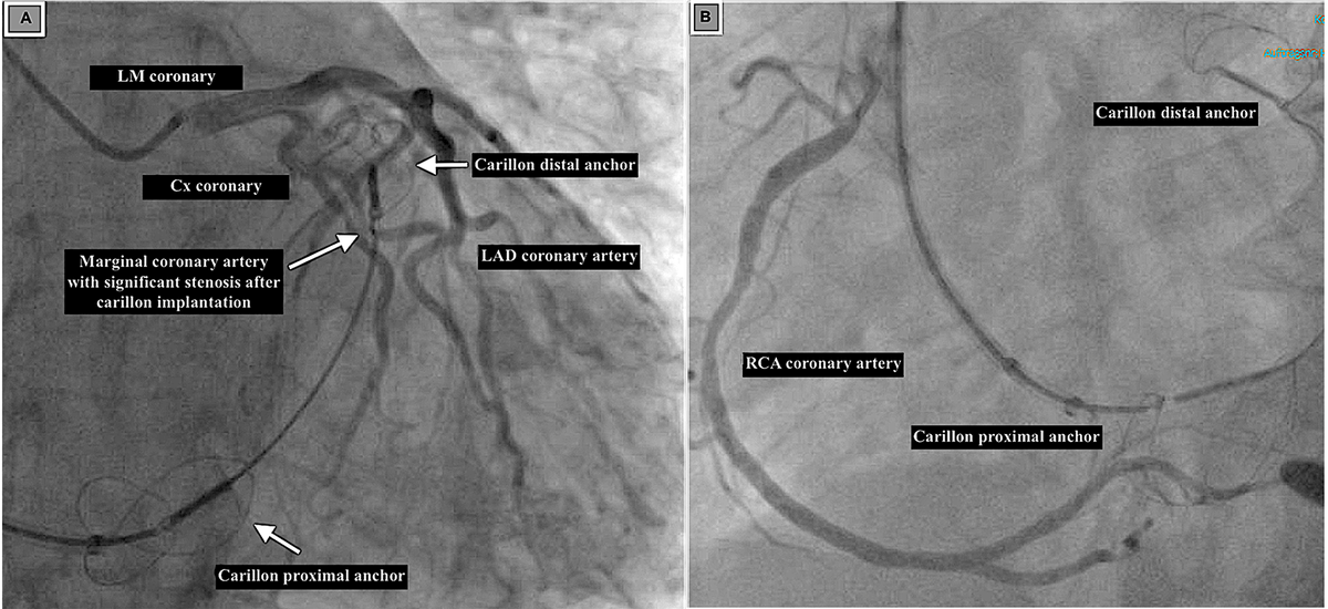 Reviews in Cardiovascular Medicine tweet media