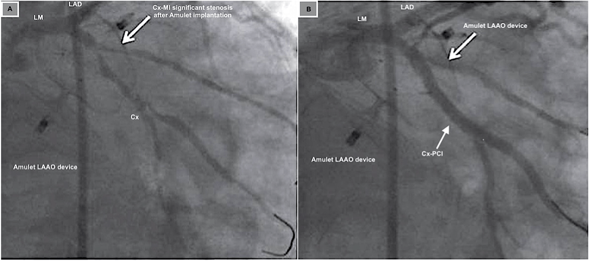 Reviews in Cardiovascular Medicine tweet media