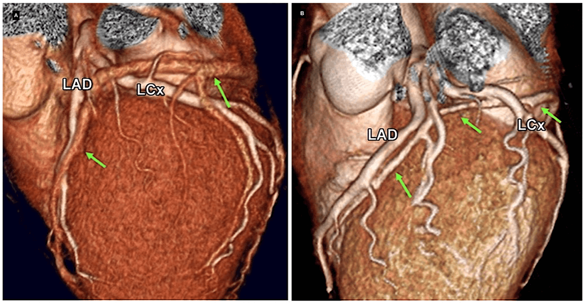 Reviews in Cardiovascular Medicine tweet media