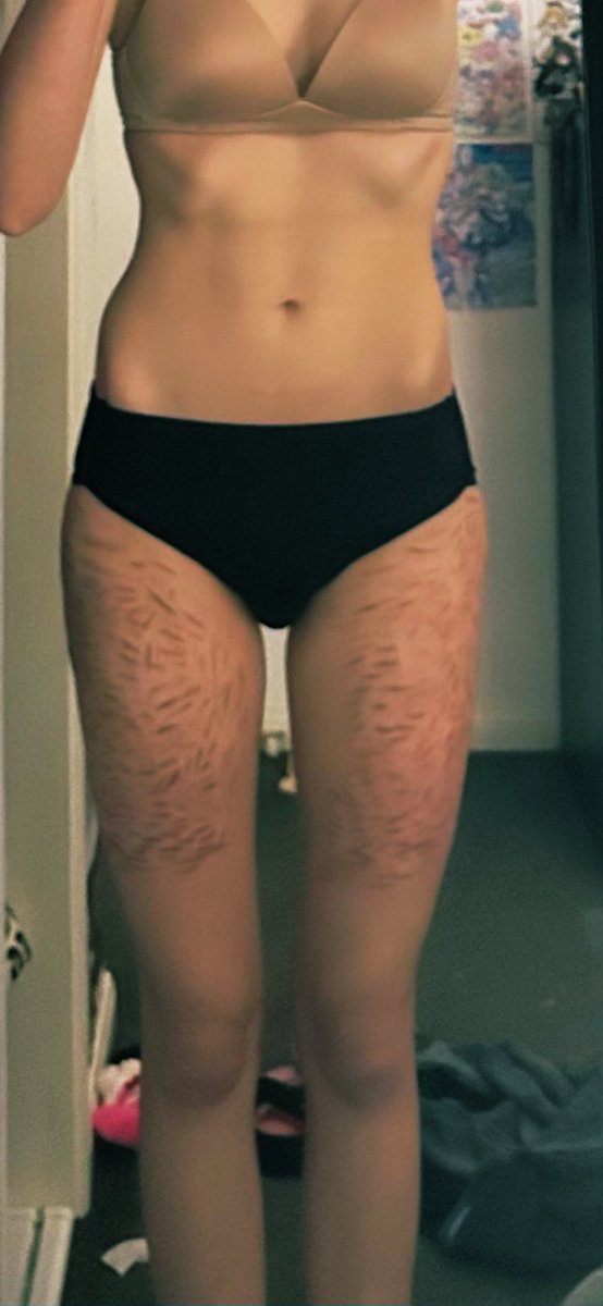 𝙽3𝙲𝚁𝙾_𝙺1𝚃𝚃𝚈💊𝚂𝙷𝙴𝙳𝚝𝚠𝚝 tweet media