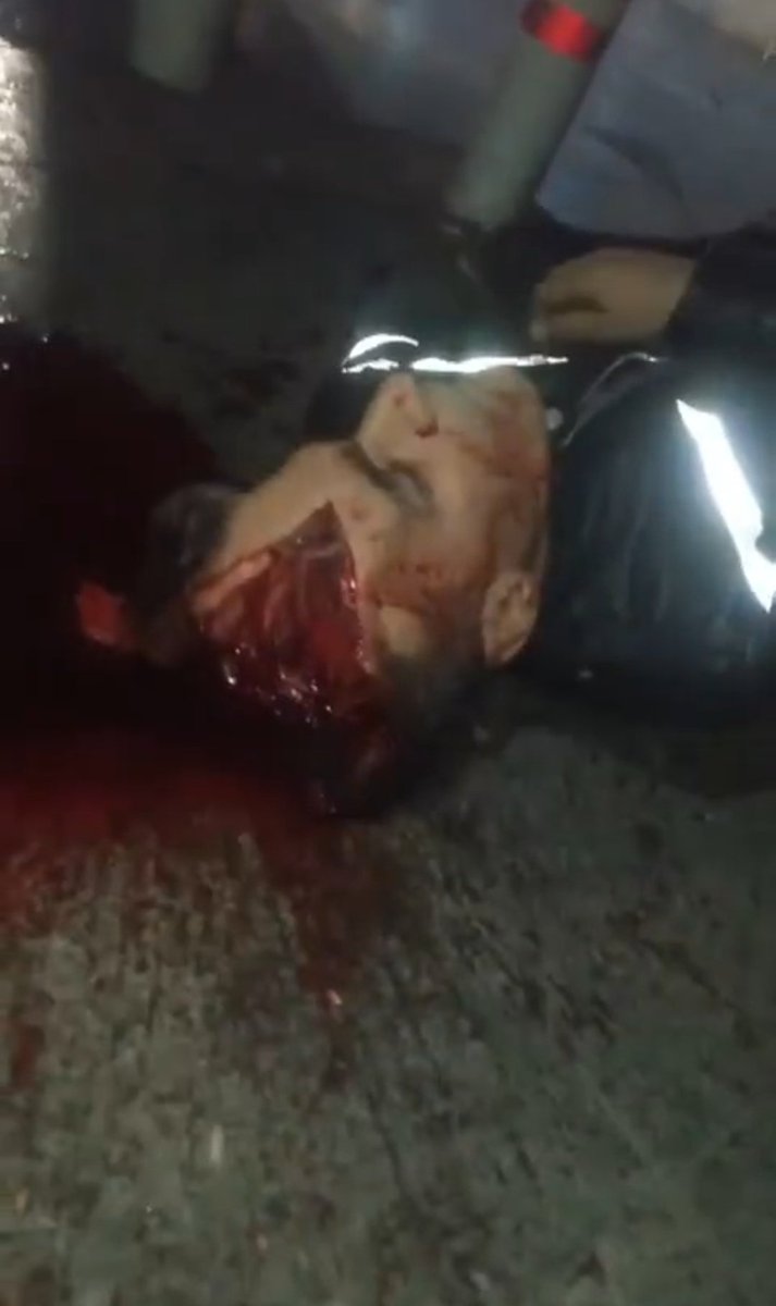 aki🍓زن زندگی آزادی🇮🇷 tweet media