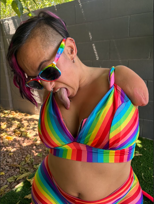 Rainbow scars, loud laughs, zero apologies. If I can stand here shining, what’s stopping you from living louder?