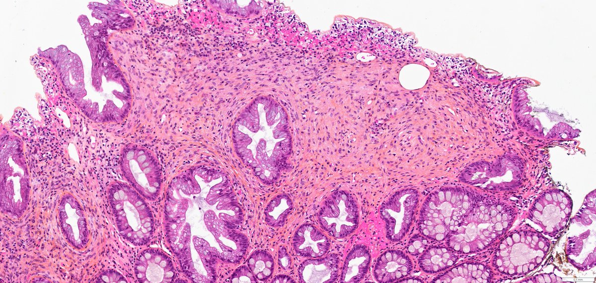 Ana-Maria Catana tweet media