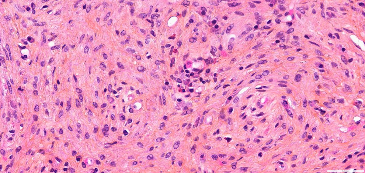 Ana-Maria Catana tweet media