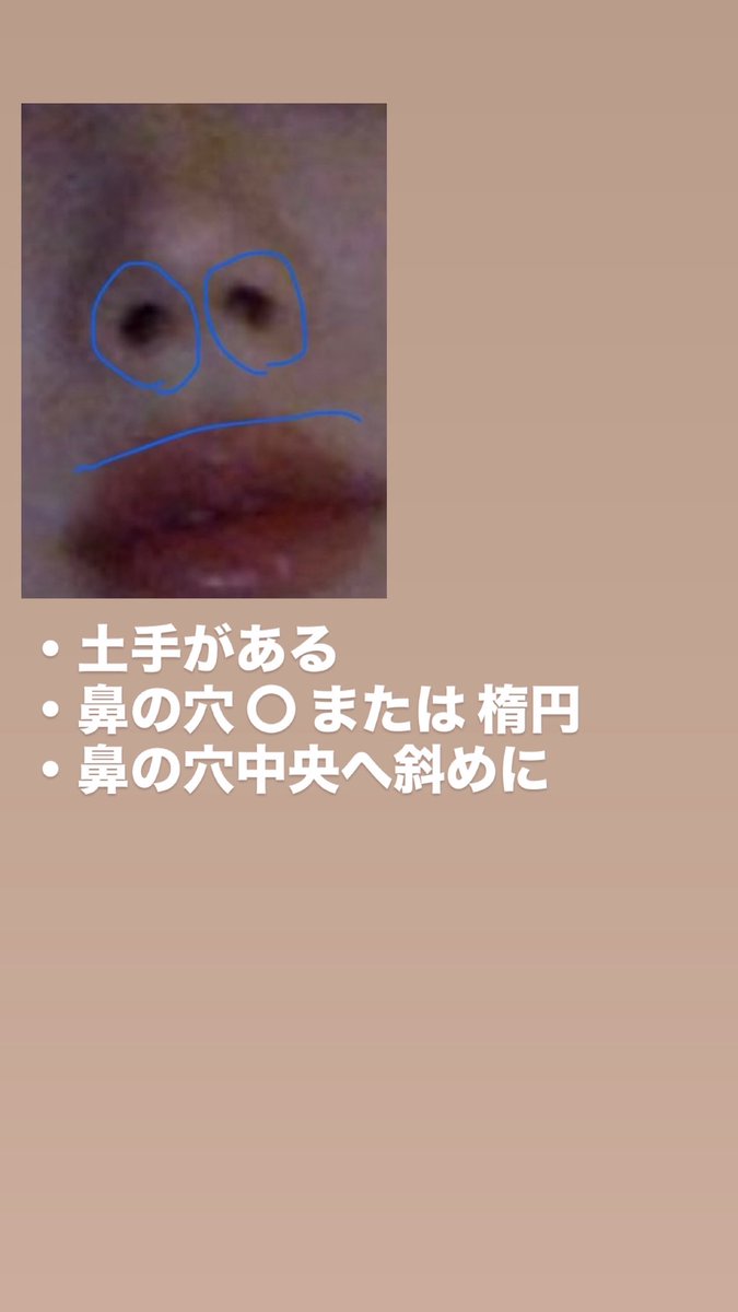 nyan_736's tweet photo. 鼻整形の資料はこちら見せました🤍

カウセ行った時に元がジゼルさんのEラインと似てるって言われたので参考にした💭

自分に近い綺麗な人or自分の加工後を見せるとナチュラルにアップデートできる気がする😌

ツリーにはなりたくない鼻を繋げてます✍🏻
4枚目はチャッピーにまとめてもらった！ https://t.co/FPrObBJQ65