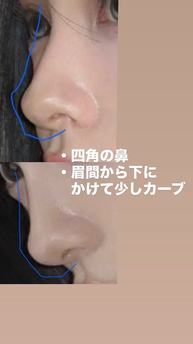 nyan_736's tweet photo. 鼻整形の資料はこちら見せました🤍

カウセ行った時に元がジゼルさんのEラインと似てるって言われたので参考にした💭

自分に近い綺麗な人or自分の加工後を見せるとナチュラルにアップデートできる気がする😌

ツリーにはなりたくない鼻を繋げてます✍🏻
4枚目はチャッピーにまとめてもらった！ https://t.co/FPrObBJQ65