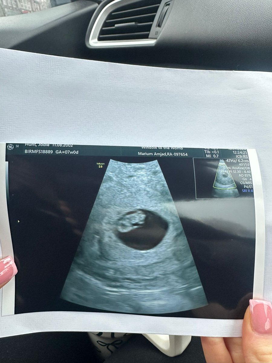 LC1878🖤💛🏌♂️⛳️ tweet media