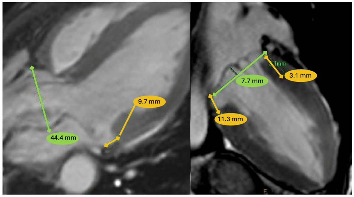 Cardiogenetics MDPI tweet media