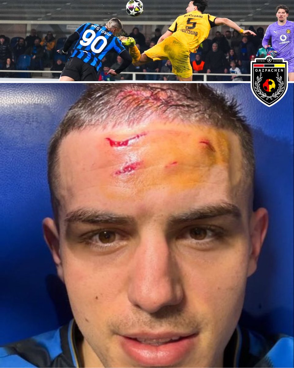 Así le quedó el rostro de Nikola Krstović tras lo que hizo Ramy Bensebaini.

Lo más insólito de todo es que el árbitro tuvo que ir a revisar la jugada al VAR para ver si era penal.

El VAR es una gran herramienta, pero los árbitros perdieron el criterio de la acción inmediata.