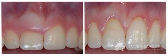 sunglasses tweet media