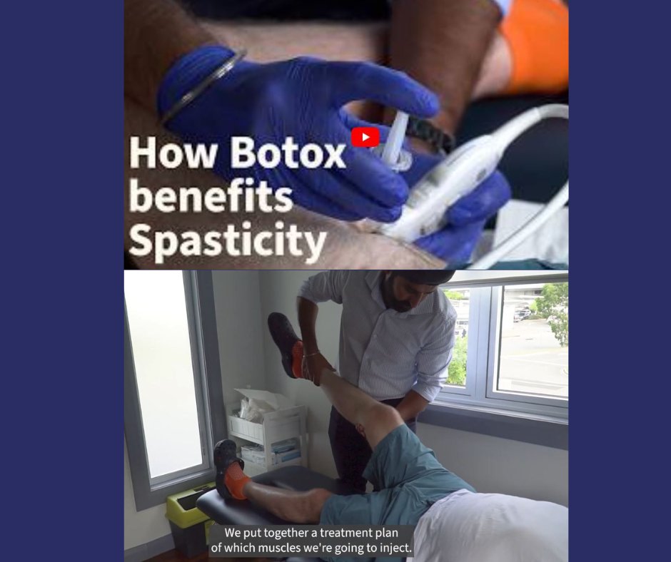 SPINALpedia's tweet image. From Spinal Life Australia:

How Botox can help in the treatment of Spasticity for people living with SCI/disability

spinalpedia.com/community/vide…

#spinalcordinjury #spasticity #botox