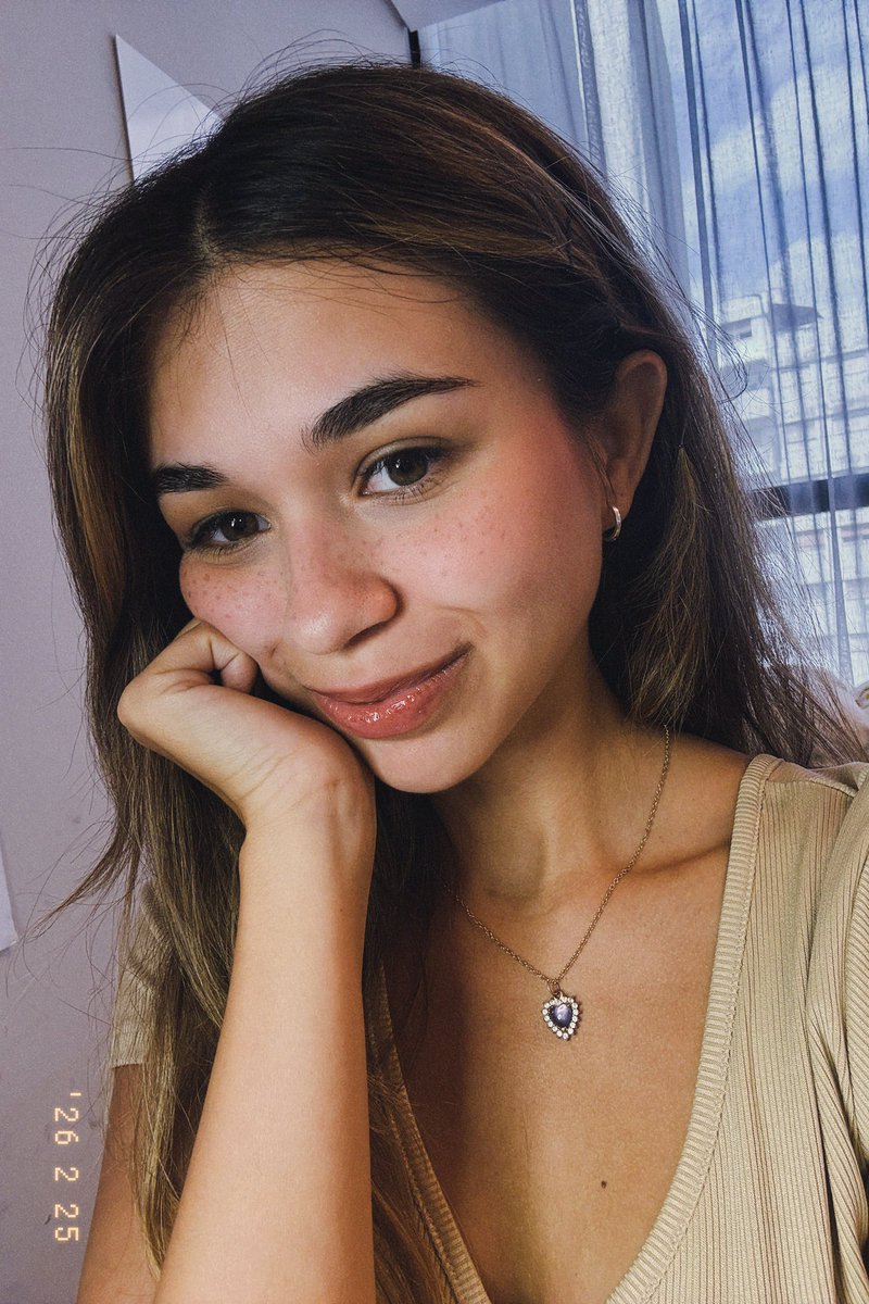 sofiaelenacl's tweet photo. Freckles https://t.co/V054ZLDJ6r