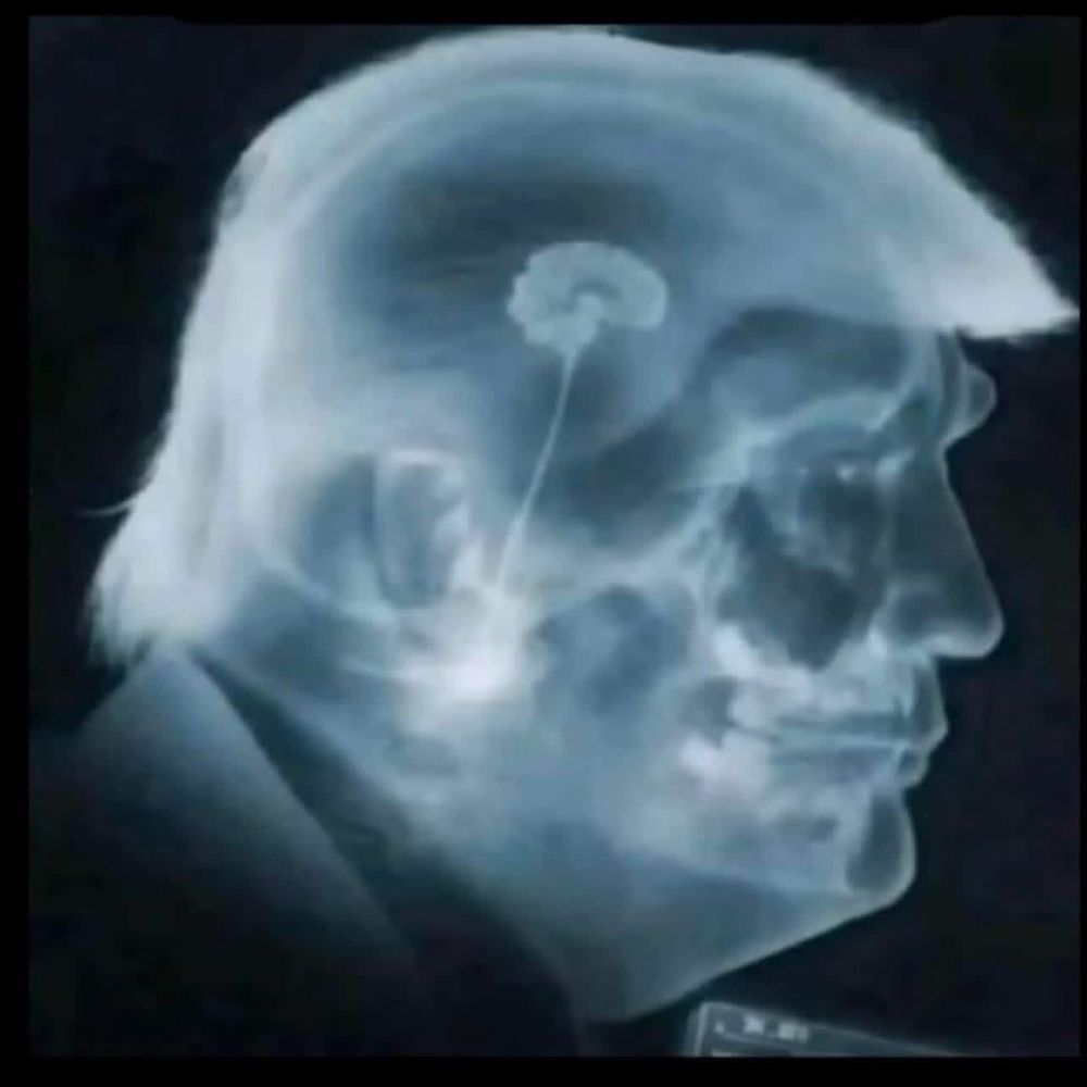 MagaSlayer83662's tweet image. #microbrain