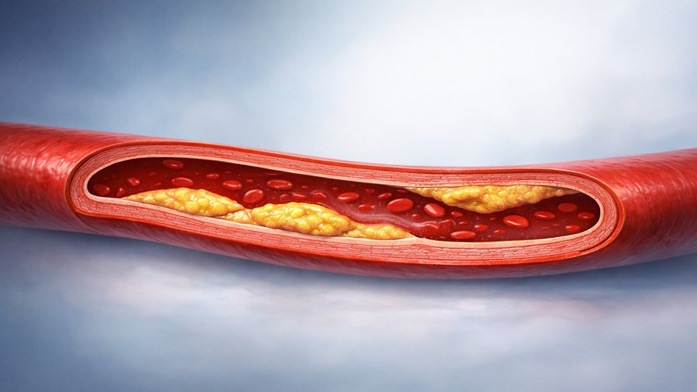 Igor Morr tweet media