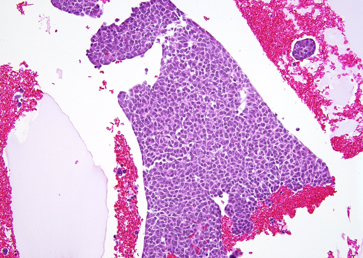 Syed Z. Ali tweet media