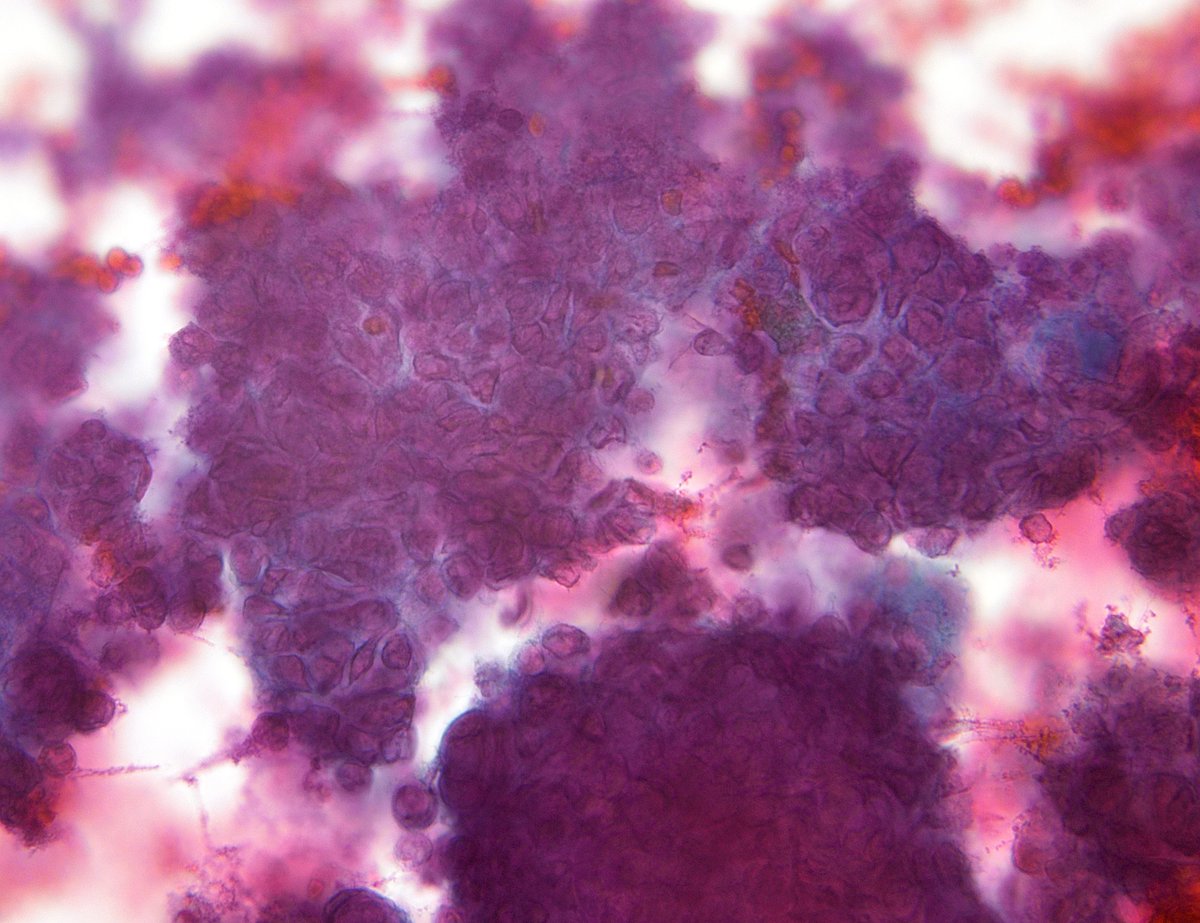 Syed Z. Ali tweet media